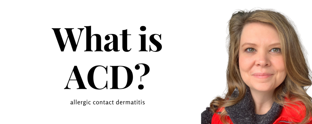 What is Allergic Contact Dermatitis?