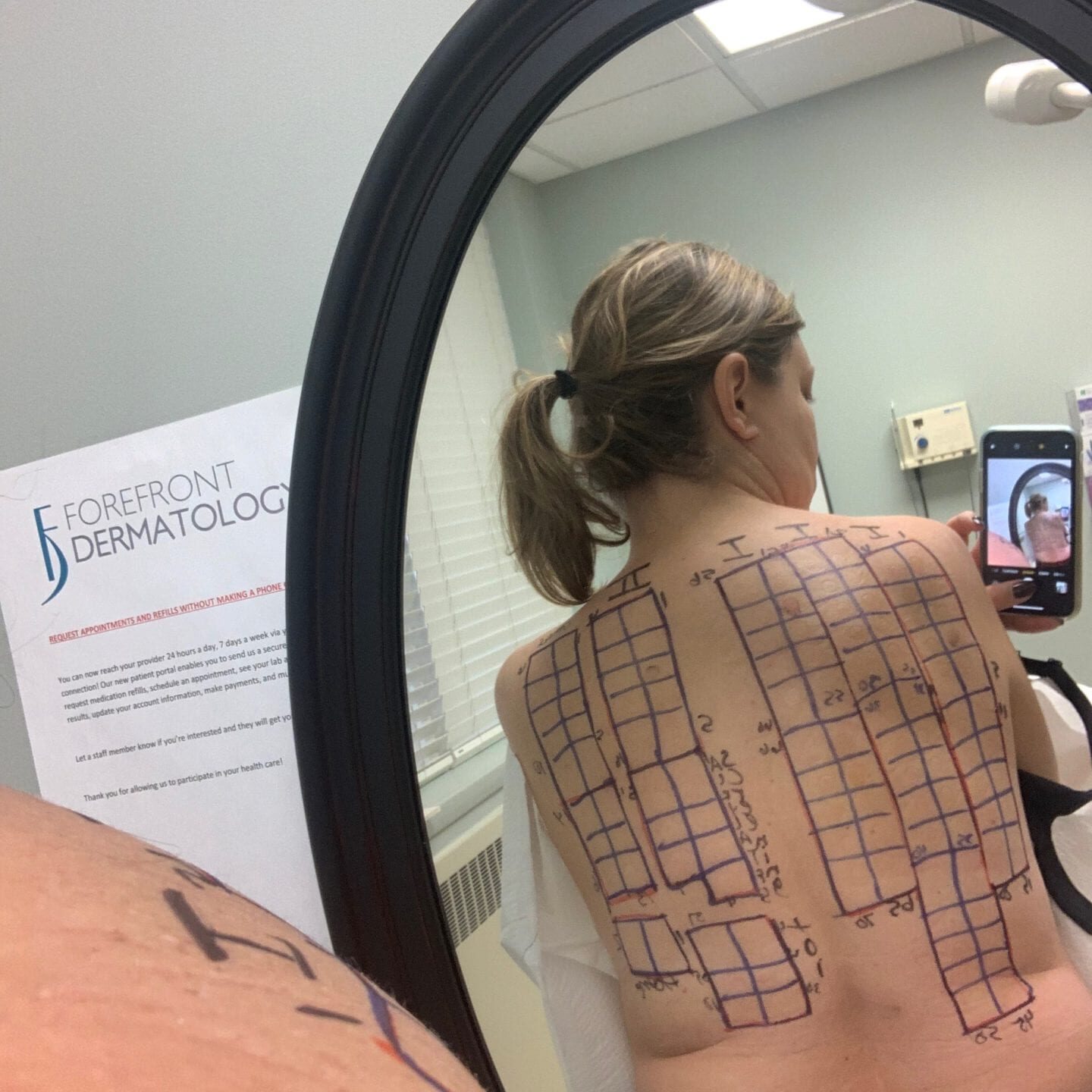 image of the map for a dermatology patch test